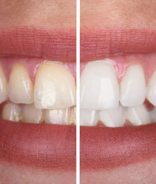 CleanDento | Prelander v2