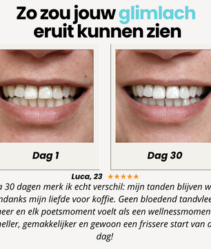 Eliavo BRUSH Teeth | Stralende tanden in seconden