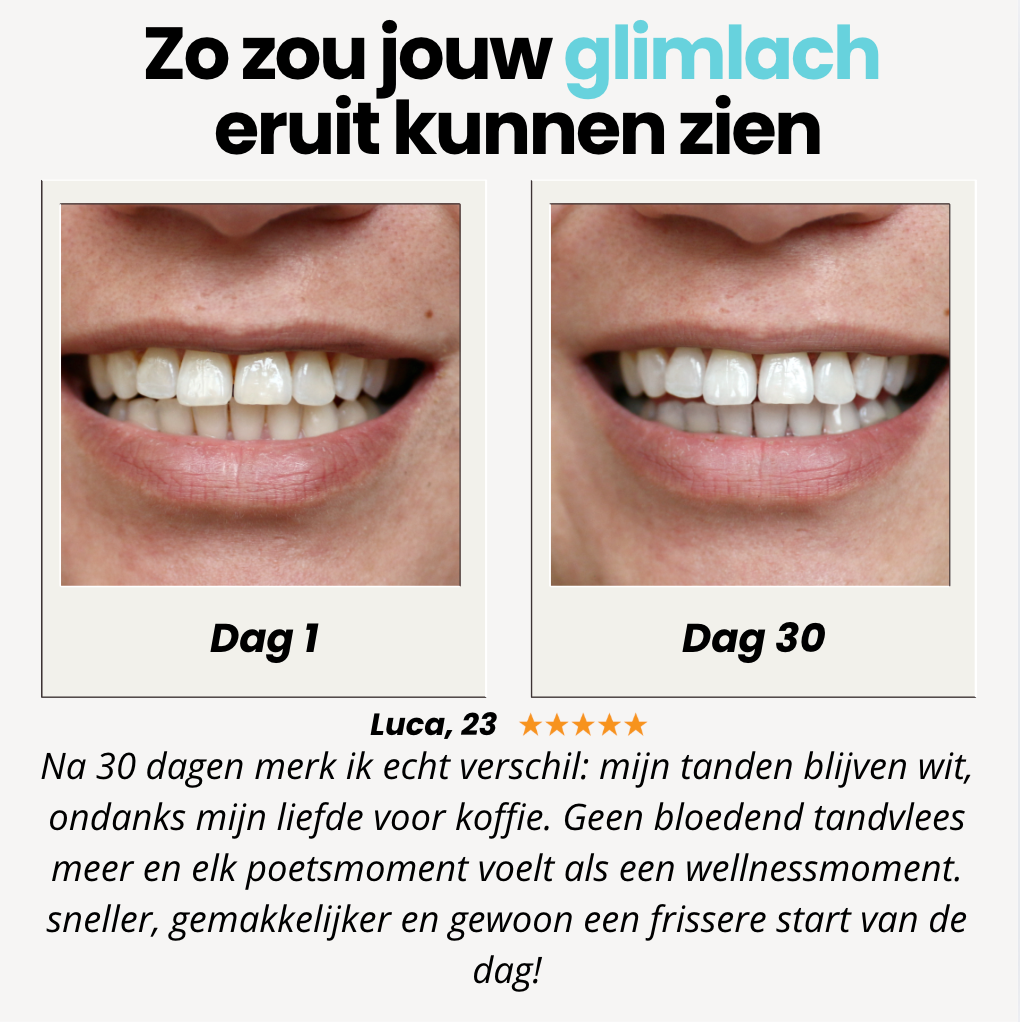 Eliavo BRUSH Teeth | Stralende tanden in seconden