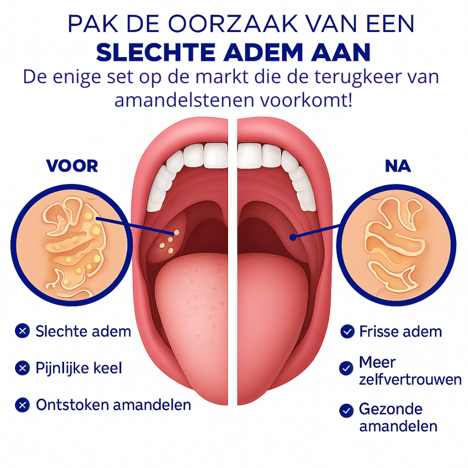 Eliavo TonsilPro | Elektrische Amandelsteentjesverwijderaar