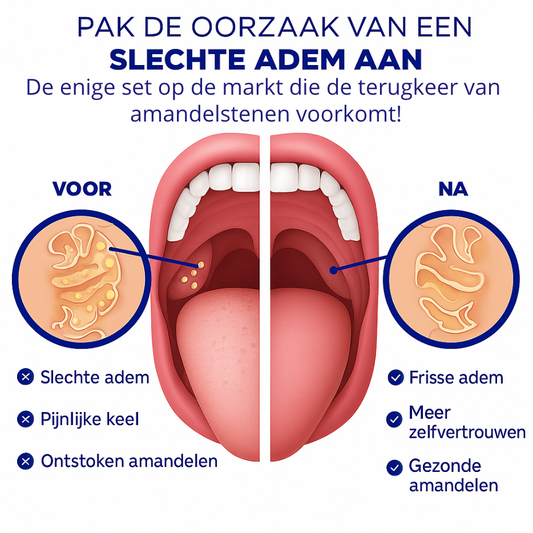 Eliavo TonsilPro | Elektrische Amandelsteentjesverwijderaar
